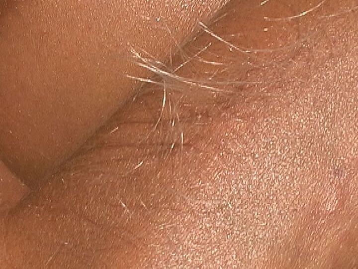 21P Beautiful tanned Lori Anderson teases with her hairy arms while sunbathing