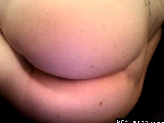 12P Freckles 18 Lick Me