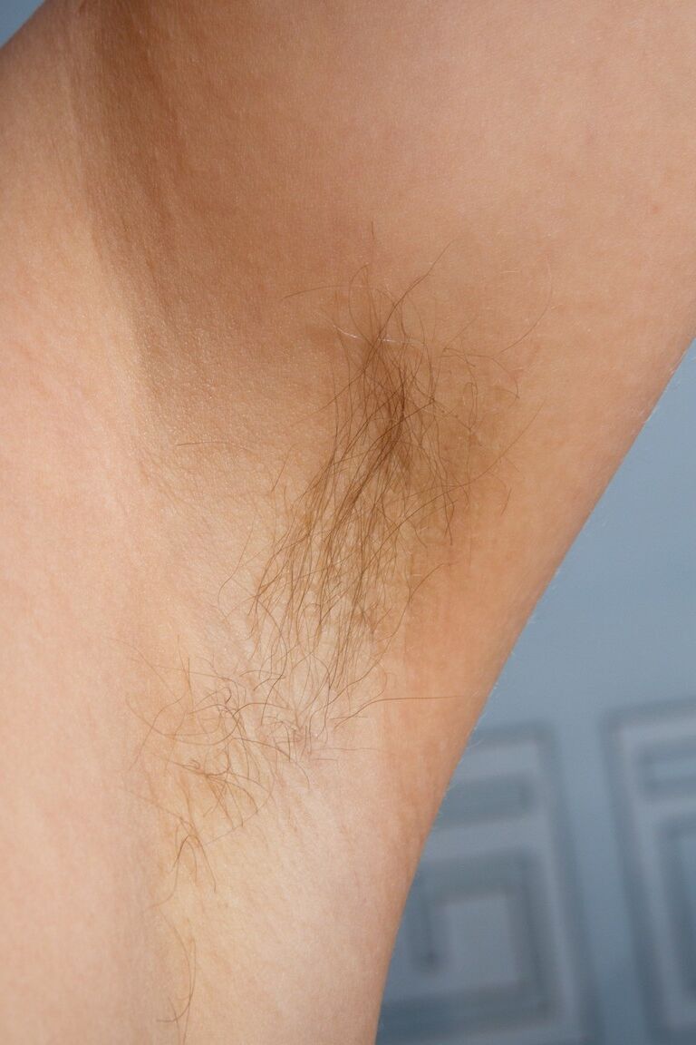 21P Lustvoller Teenager mit haarigen Achseln Loredana entblößt ihren Busch und posiert auf einem Bett