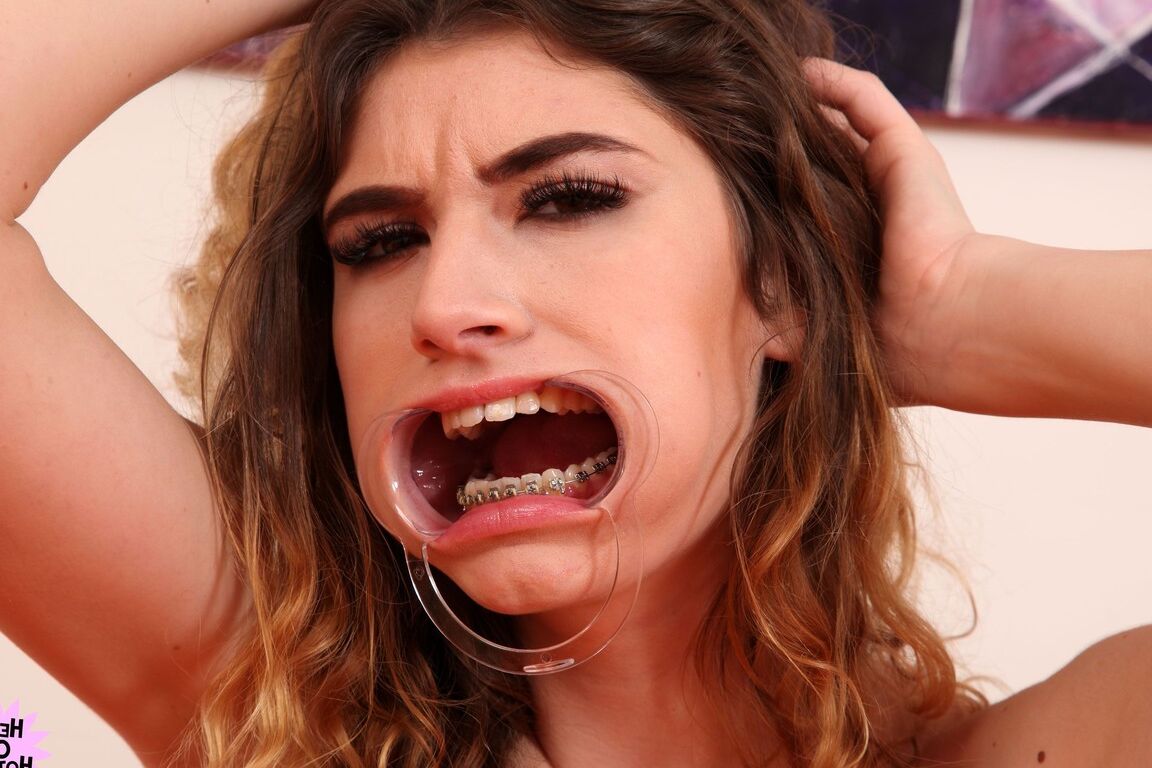 21P La adolescente caliente Candice Demellza abre su dulce boca