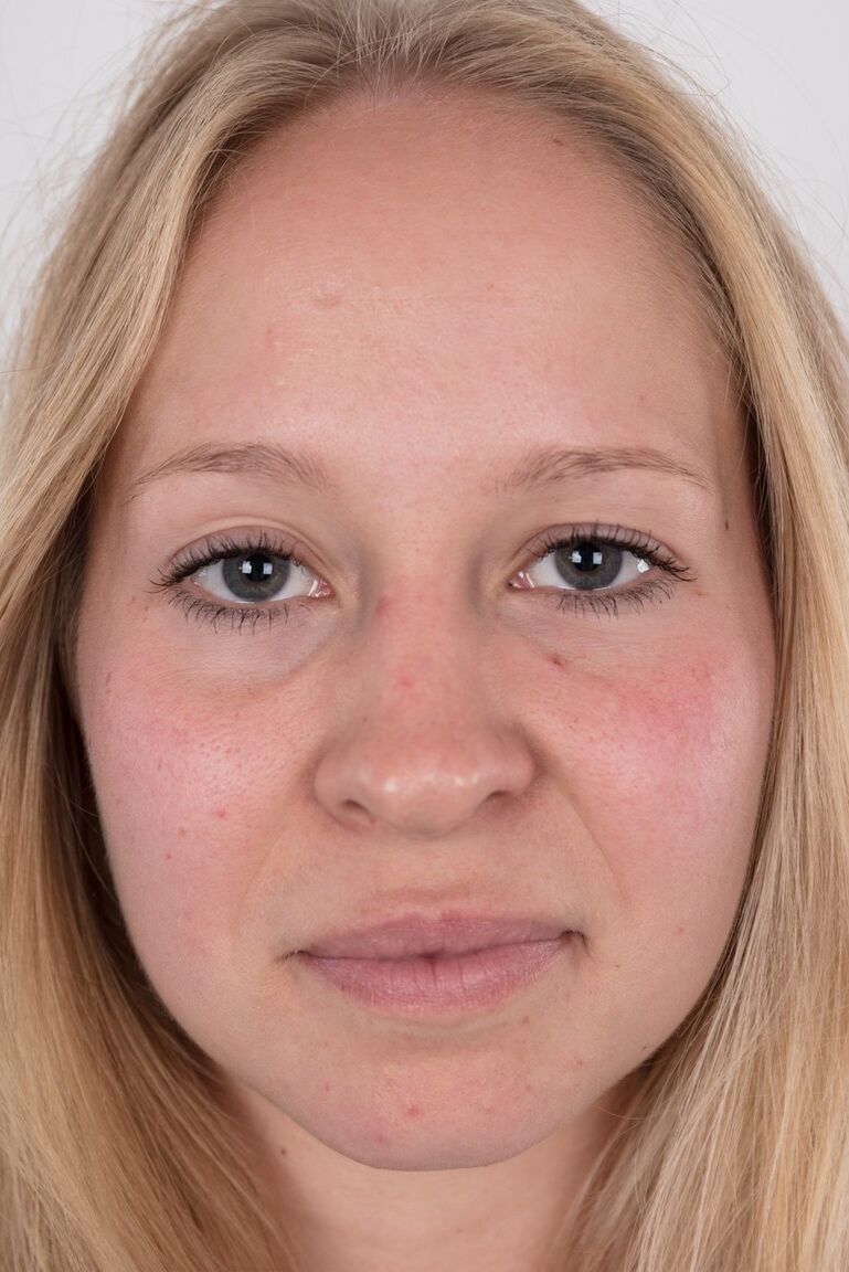 20P Blonde Amateurin Veronika entblößt ihre gebräunten Titten in schwarzer Unterwäsche