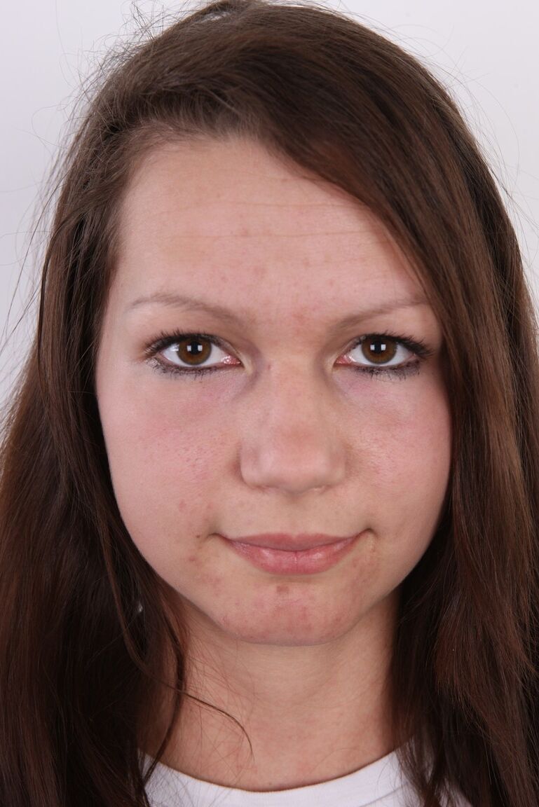 20P Amateur girl with complexion issues stands butt naked after getting undressed