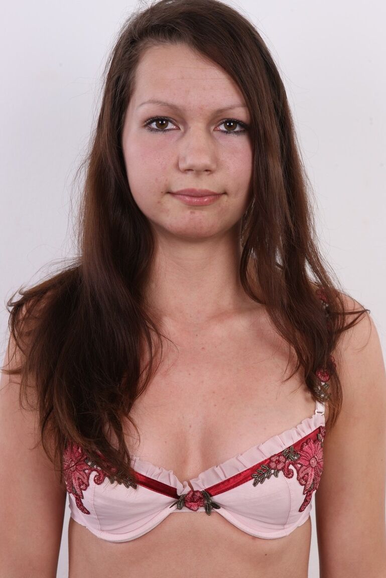 20P Amateur girl with complexion issues stands butt naked after getting undressed