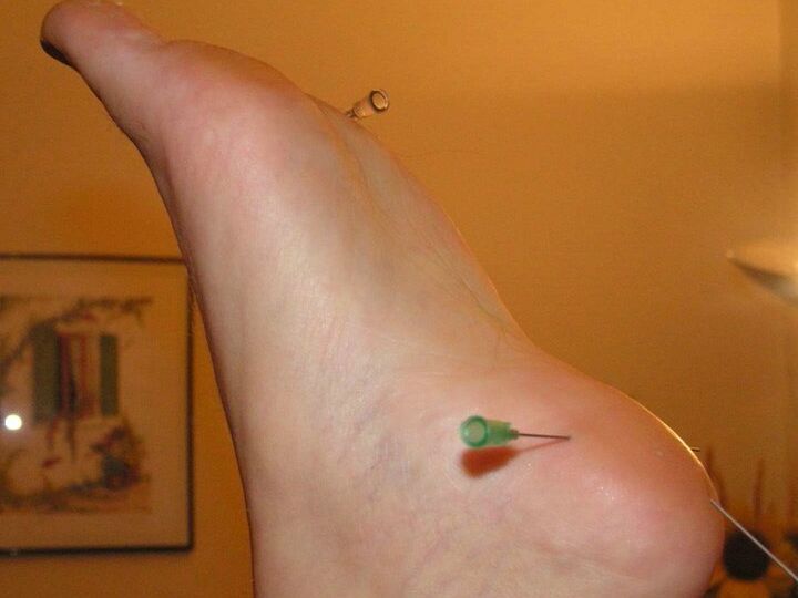 12P Restrained white girl has needles inserted into various body parts