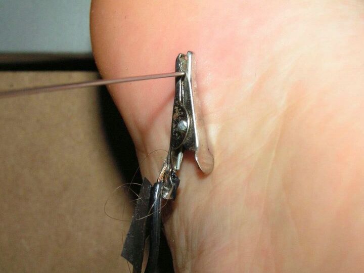 12P Restrained white girl has needles inserted into various body parts