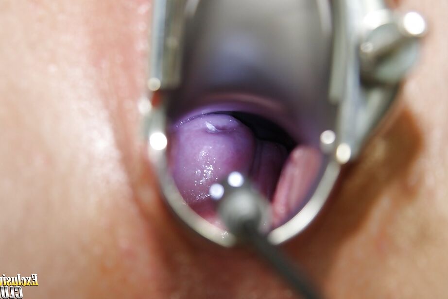 16P Close up doctor check of an formidable babe Alexa Bold with gyno tits