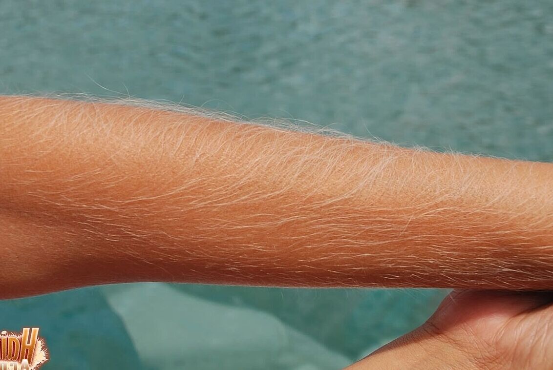 21P Americana de cabelos compridos MILF Lori Anderson exibindo seus braços muito peludos