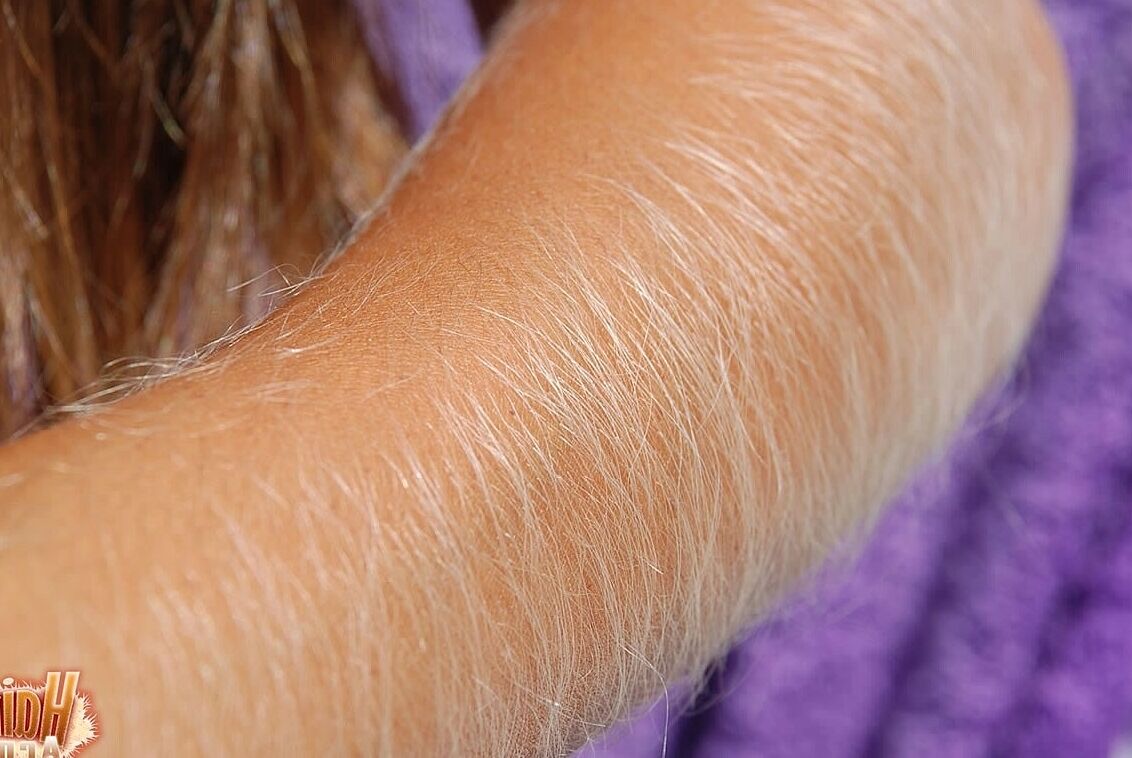21P Americana de cabelos compridos MILF Lori Anderson exibindo seus braços muito peludos