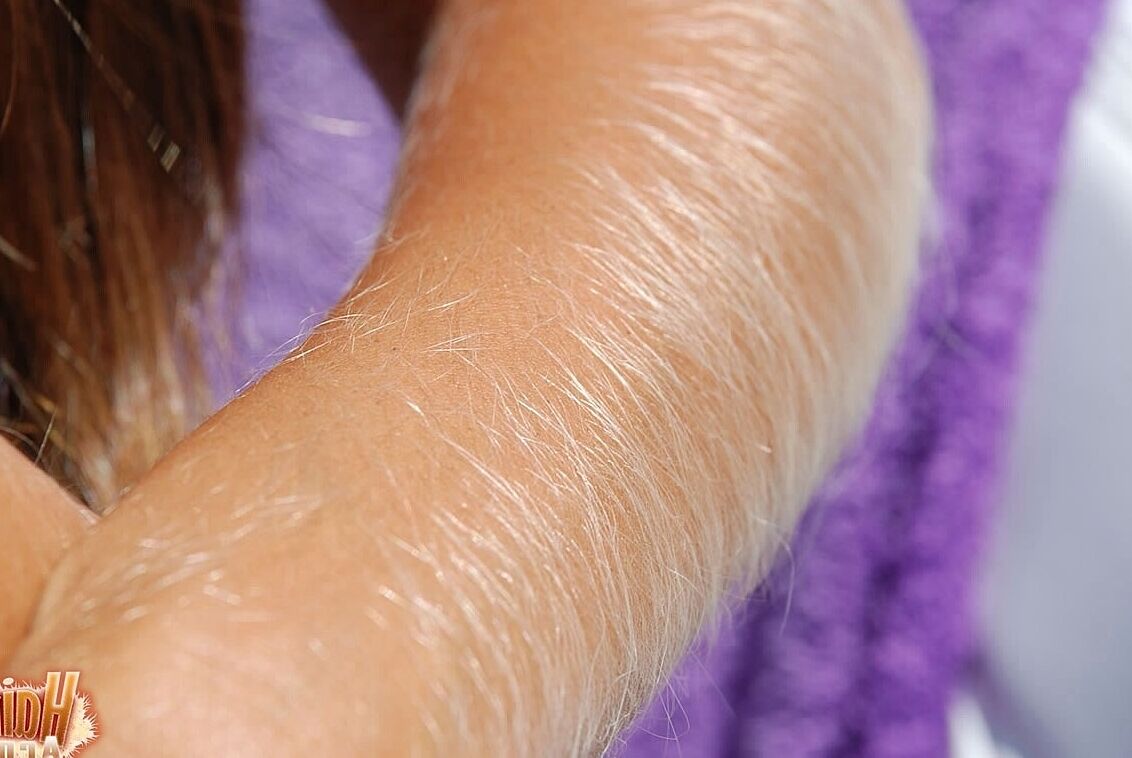 21P Americana de cabelos compridos MILF Lori Anderson exibindo seus braços muito peludos