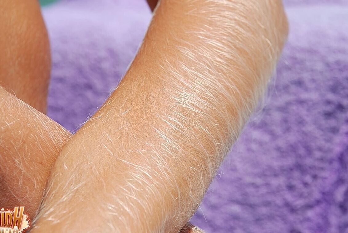 21P Americana de cabelos compridos MILF Lori Anderson exibindo seus braços muito peludos
