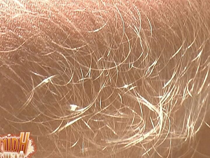21P La MILF estadounidense Lori Anderson muestra sus brazos muy peludos en traje de baño