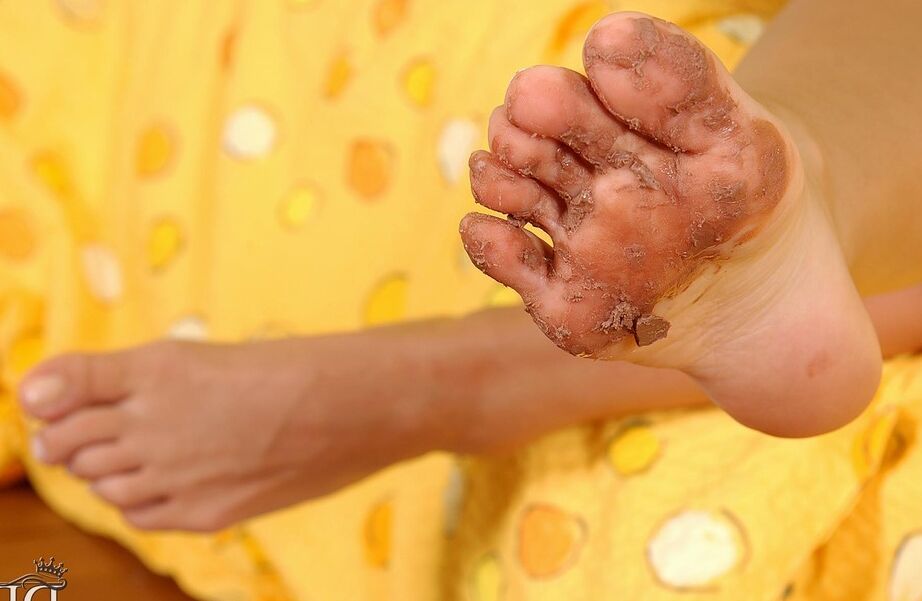 16P Mulheres com pernas compridas brincam com os pés enquanto têm relações lésbicas com brinquedos sexuais
