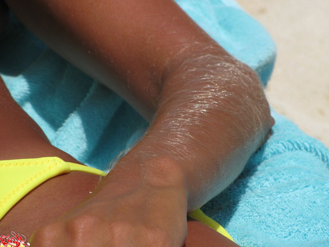 14P La amateur solitaria Lori Anderson muestra sus brazos peludos en un bikini amarillo