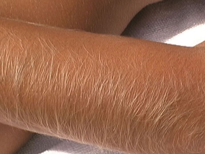 21P, la salope américaine Lori Anderson exhibe ses bras très poilus.