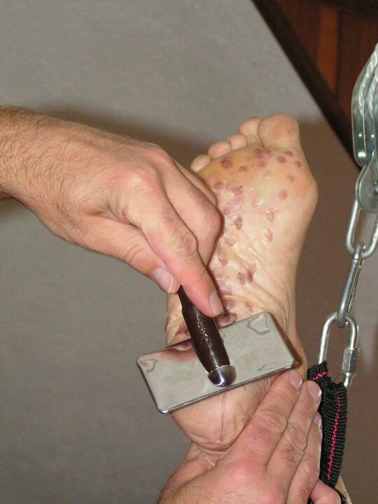 12P Restrained female has needles inserted into her bare feet