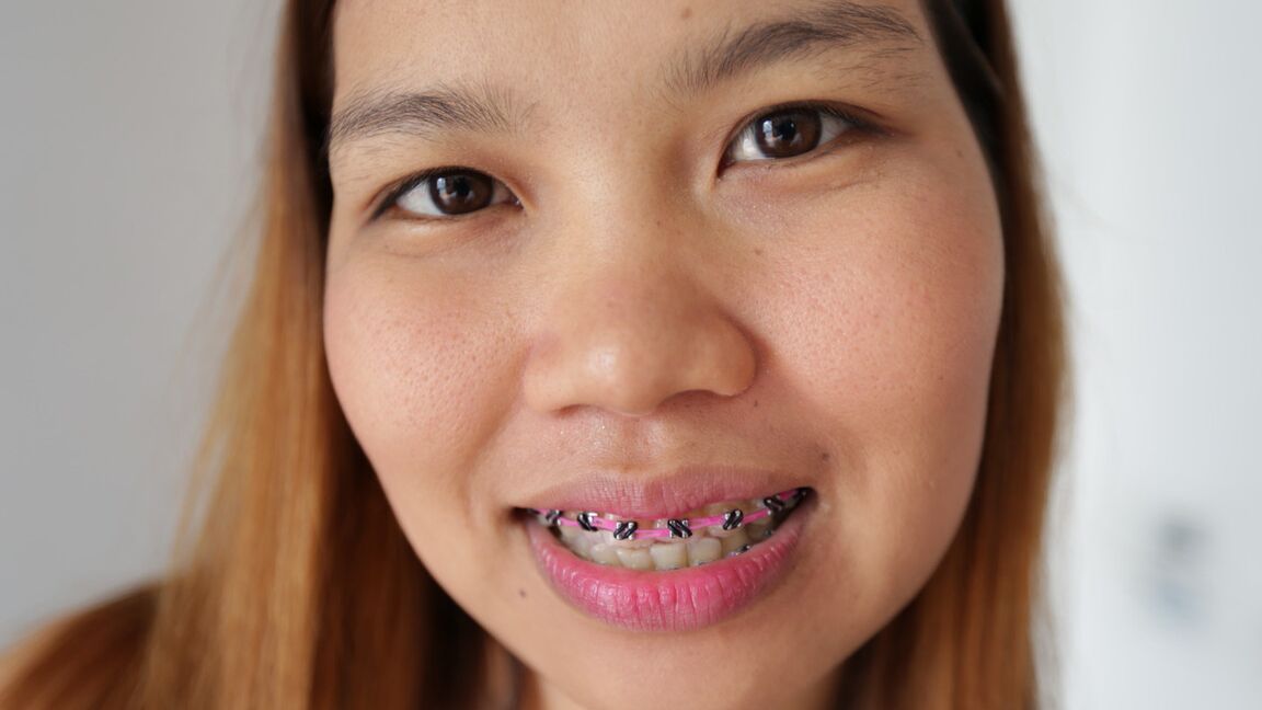 21P Asiatisches Sextagebuch Aw