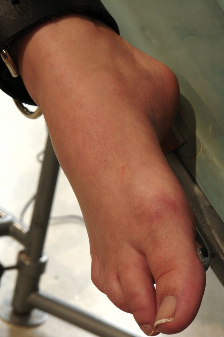 20 Pics Redheaded American gets toyed while bound to a cold steel table
