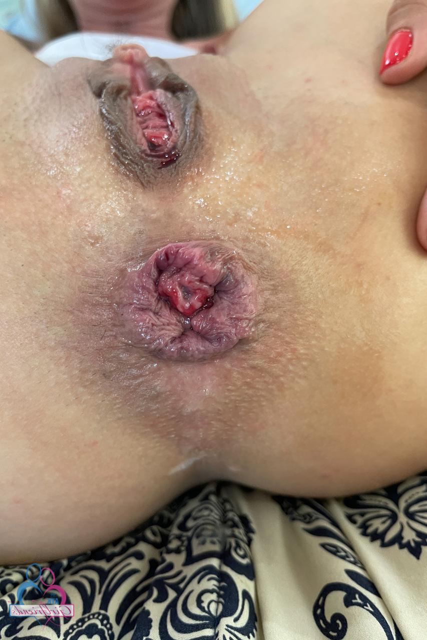 20P A enfermeira amadora Summer Vixen mostra sua buceta de perto com um absorvente interno inserido