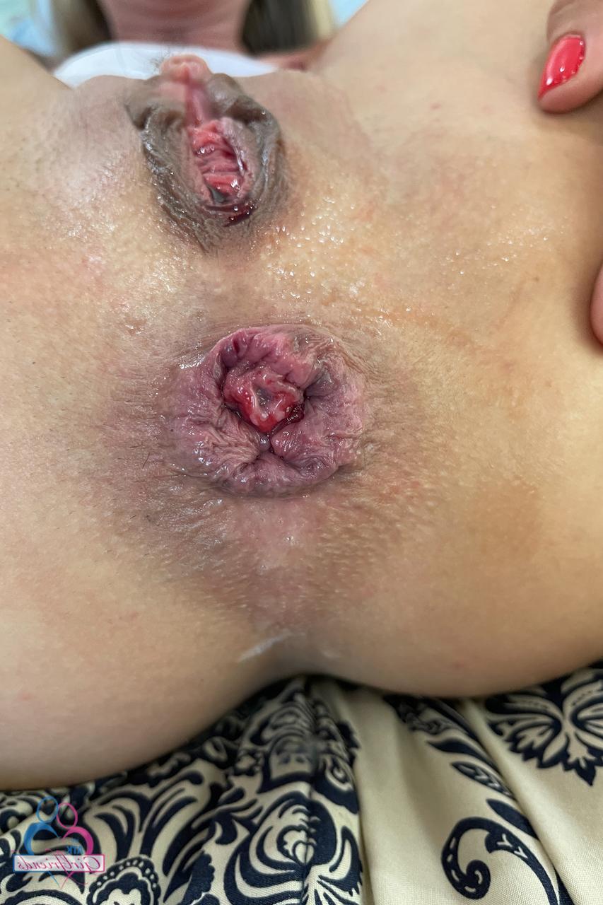 20P A enfermeira amadora Summer Vixen mostra sua buceta de perto com um absorvente interno inserido