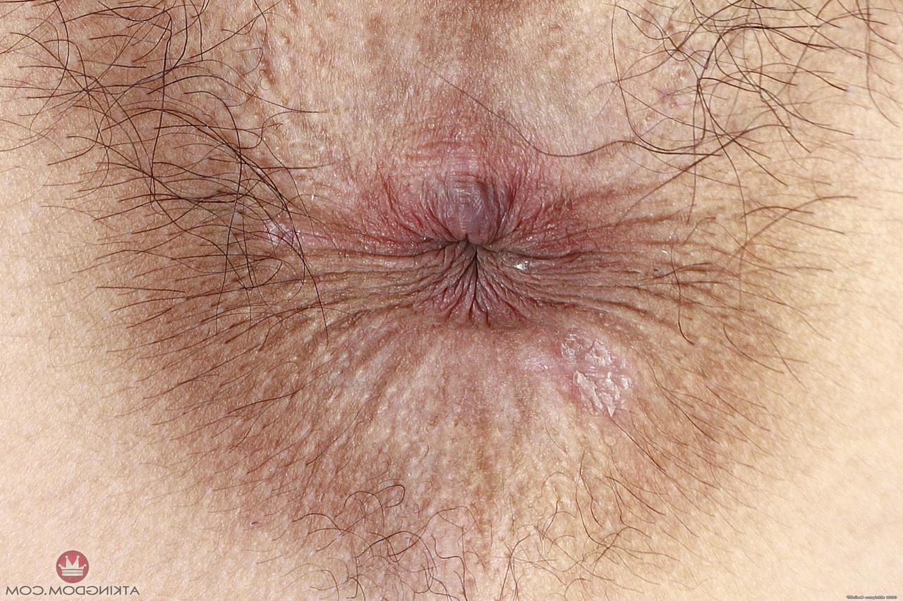 20P Amateur hottie Iris Ivy displays her hairy holes and spreads them wide open