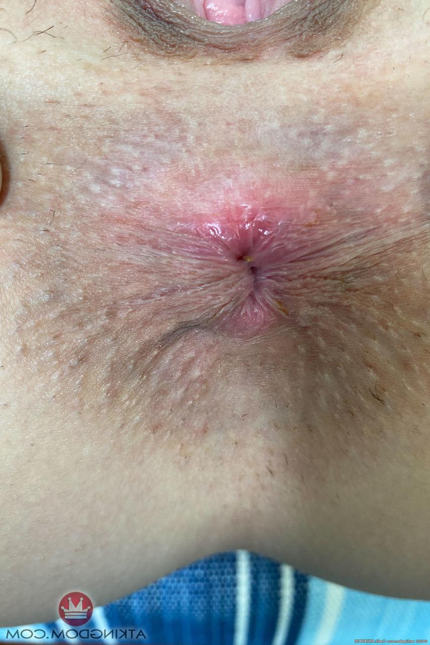 20P Das hübsche Babe Lily Adams zeigt ihre fleischige Muschi und ihr enges Arschloch aus nächster Nähe