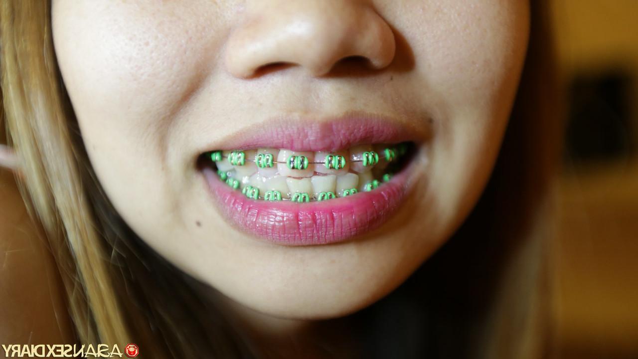 20P Cute Asian babe with braces Aw strips, poses naked and fucks in POV
