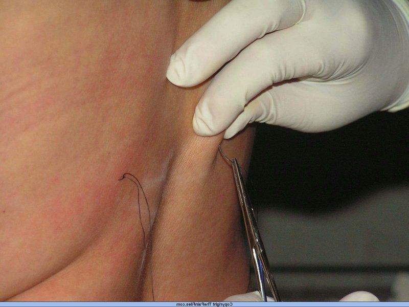 12P Lésbicas com excesso de peso brincam com agulhas em uma masmorra