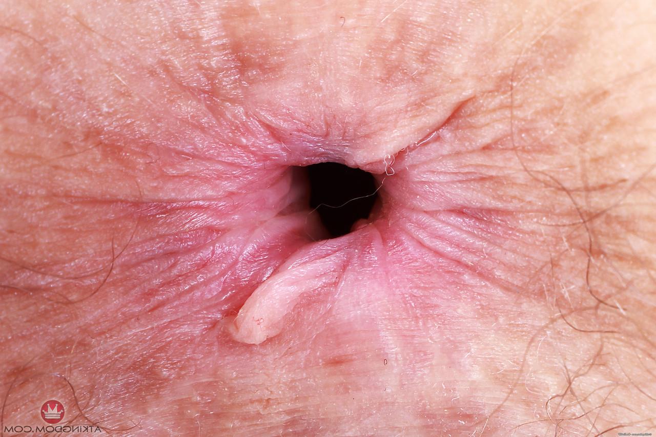 20P Caucasian nerd Jackie Hoff unveils her big saggy tits and hairy pussy