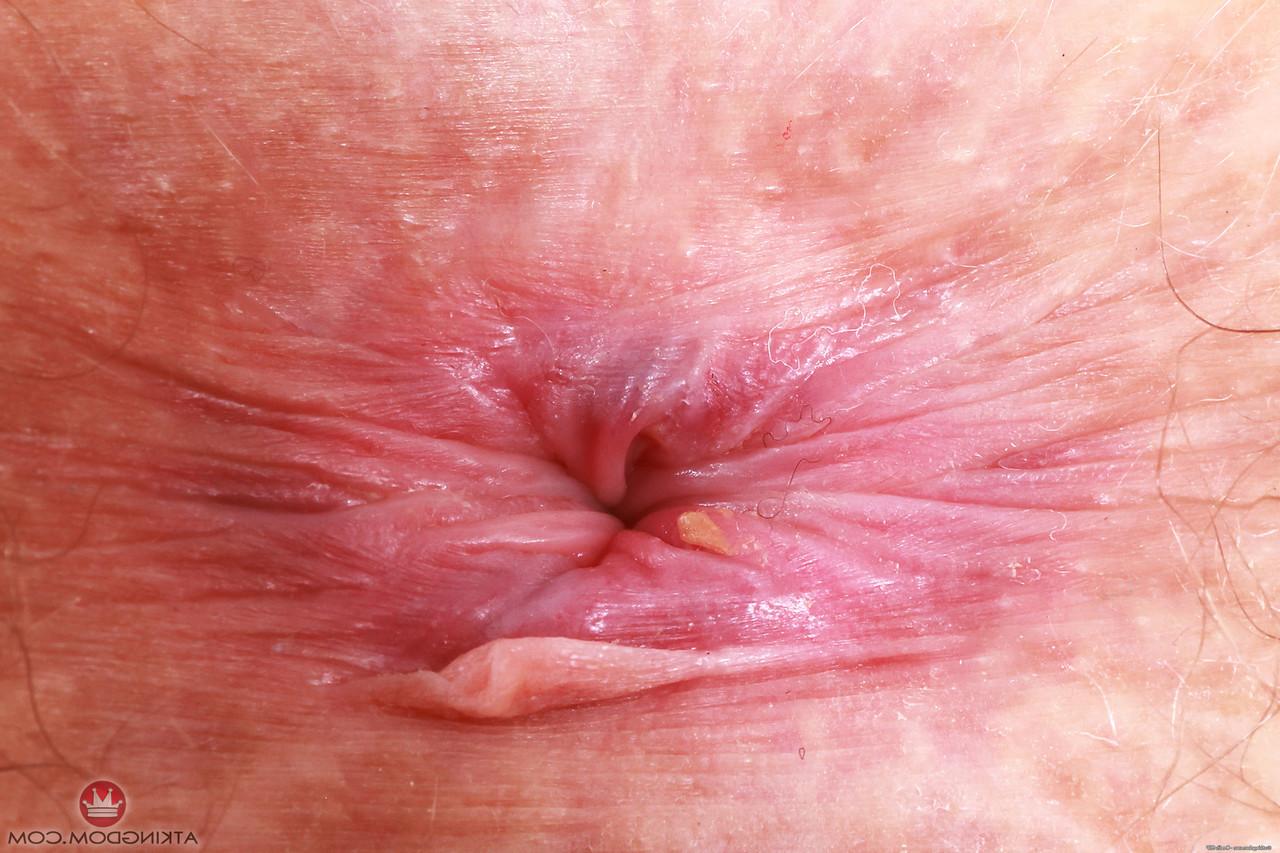 20P La tetona amateur jackie hoff muestra sus tetas caídas y abre su coño peludo