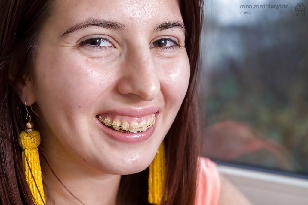 16P Close ups of braces adorned amateur Andreea showing off big natural tits
