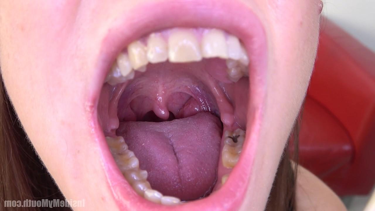 15P Inside My Mouth 