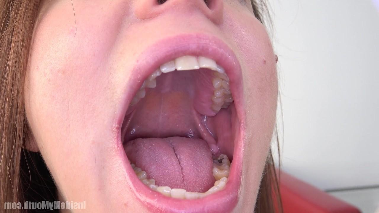 15P Inside My Mouth 