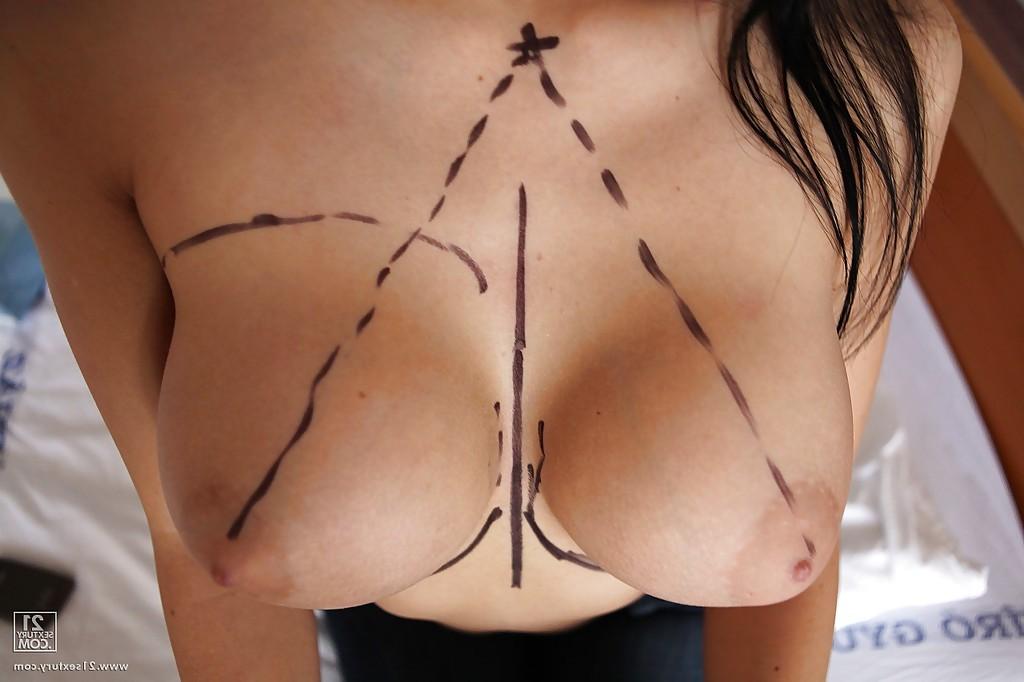 16P Aletta Ocean goes through successful plastic surgery operation