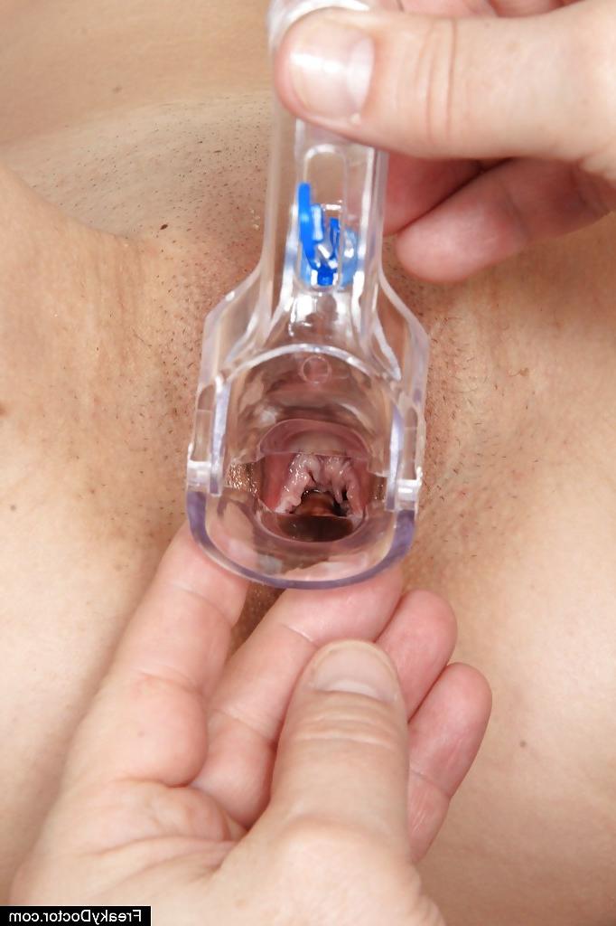 16P Teen girlfriend Aneta came at the elder doctor for gyno fetish orgasm